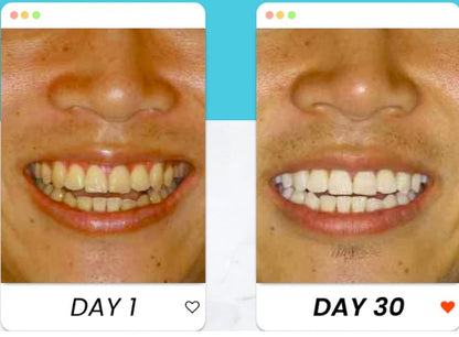 Cepillo de dientes sonico