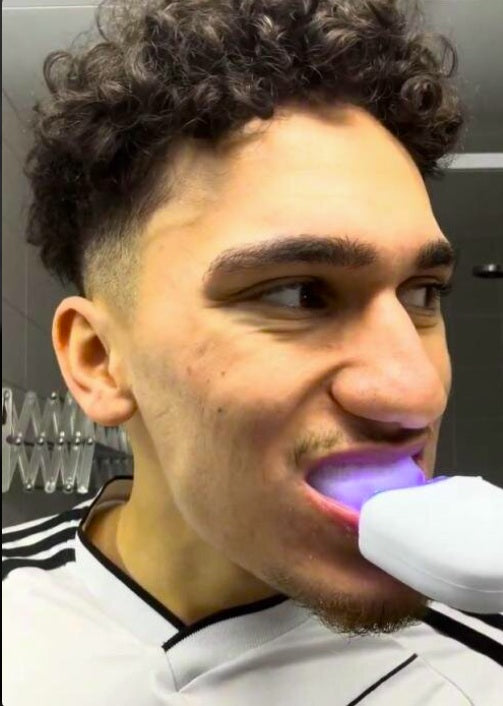 Cepillo de dientes sonico